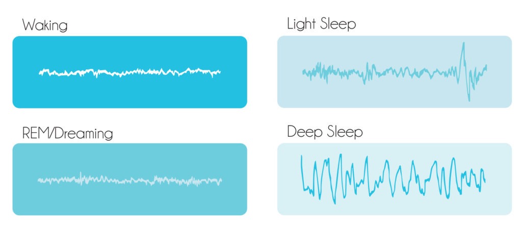Rem Sleep Stages Chart